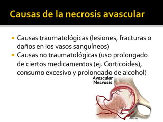    Causas traumatológicas (lesiones, fracturas o
    daños en los vasos sanguíneos)
   Causas no traumatológicas (uso prolongado
    de ciertos medicamentos (ej. Corticoides),
    consumo excesivo y prolongado de alcohol)
 