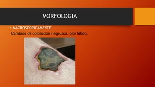 necrosis-gangrenosa-pptx