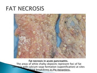 Necrosis | PPT