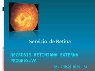 NECROSIS RETINIANA EXTERNA
PROGRESIVA
DR. CARLOS GRAU R2
Servicio de Retina
 