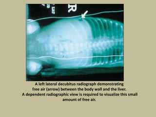 A left lateral decubitus radiograph demonstrating
free air (arrow) between the body wall and the liver.
A dependent radiographic view is required to visualize this small
amount of free air.
 