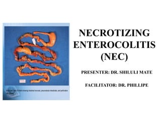 NECROTIZING
ENTEROCOLITIS
(NEC)
PRESENTER: DR. SHILULI MATE
FACILITATOR: DR. PHILLIPE
 