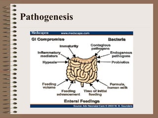 Pathogenesis
 