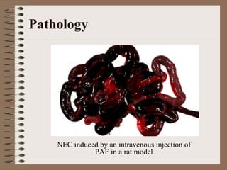 Pathology




    NEC induced by an intravenous injection of
              PAF in a rat model
 