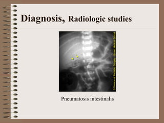 Diagnosis, Radiologic studies




          Pneumatosis intestinalis
 