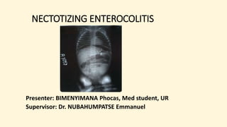 NECTOTIZING ENTEROCOLITIS
Presenter: BIMENYIMANA Phocas, Med student, UR
Supervisor: Dr. NUBAHUMPATSE Emmanuel
 