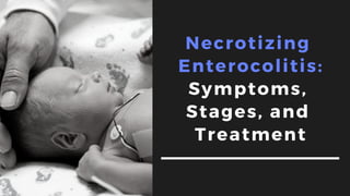 Necrotizing
Enterocolitis:
Symptoms,
Stages, and
Treatment
 