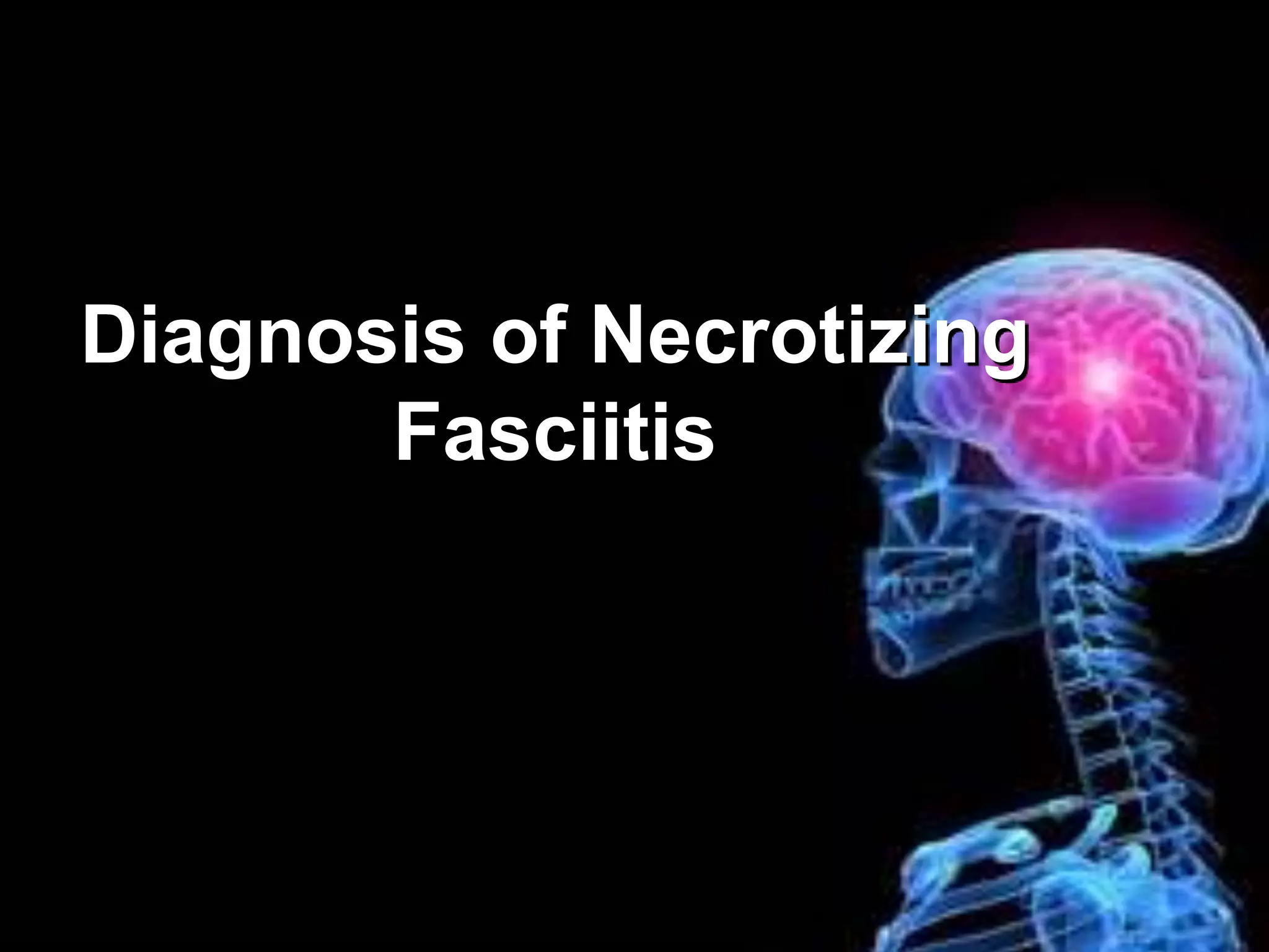 Diagnosis of Necrotizing
       Fasciitis
 