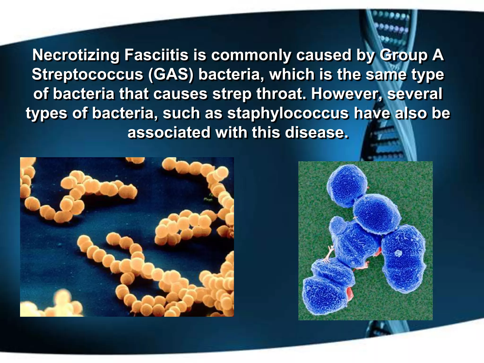 Necrotizing Fasciitis is commonly caused by Group A
 Streptococcus (GAS) bacteria, which is the same type
 of bacteria that causes strep throat. However, several
types of bacteria, such as staphylococcus have also be
              associated with this disease.
 
