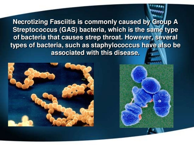 Necrotizing Fasciitis Bacteria