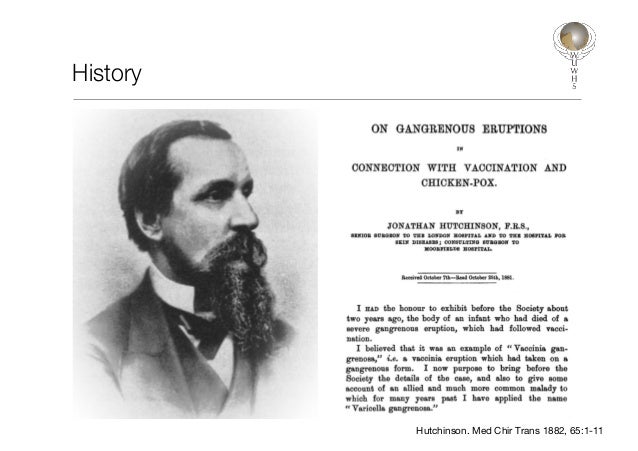 Necrotizing fasciitis