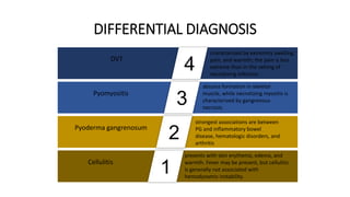 DVT
characterized by extremity swelling,
pain, and warmth; the pain is less
extreme than in the setting of
necrotizing infection.
Pyomyositis
abscess formation in skeletal
muscle, while necrotizing myositis is
characterized by gangrenous
necrosis.
Pyoderma gangrenosum
strongest associations are between
PG and inflammatory bowel
disease, hematologic disorders, and
arthritis
Cellulitis
presents with skin erythema, edema, and
warmth. Fever may be present, but cellulitis
is generally not associated with
hemodynamic instability.
DIFFERENTIAL DIAGNOSIS
1
2
3
4
 