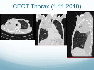 CECT Thorax (1.11.2018)
 