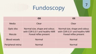 necrotizing scleritis - CASE PRESENTATION | PPTX