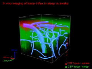 The Glymphatic System – A New Player in Alzheimer Disease? | PPTX