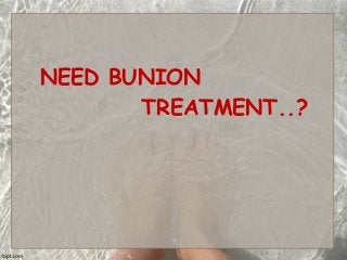 NEED BUNION
TREATMENT..?

 