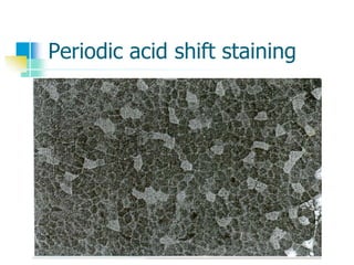 Periodic acid shift staining
 