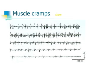 Muscle cramps show
 