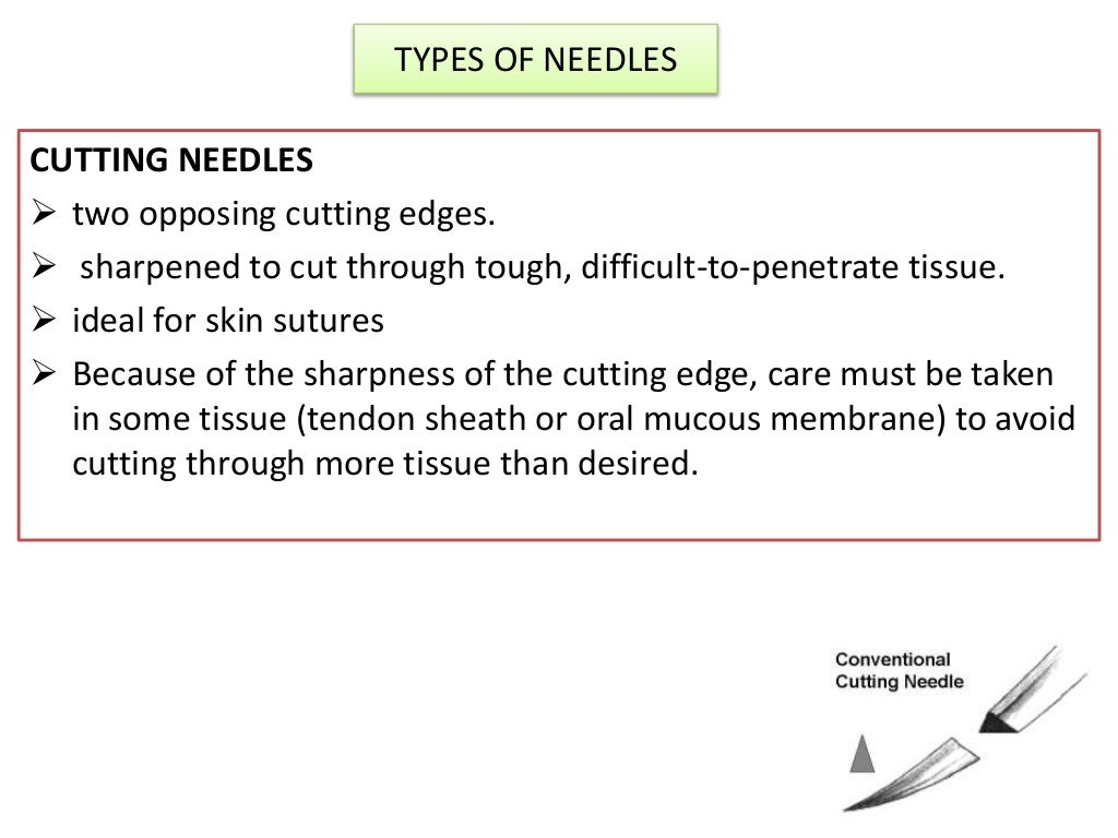 Surgical needles basics