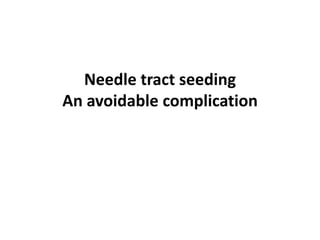 Needle tract seeding
An avoidable complication
 