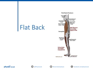 Flat Back
@Physiocouk #manchesterphysio facebook.com/physiocouk
 