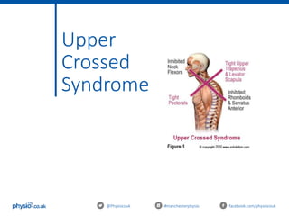 Upper
Crossed
Syndrome
@Physiocouk #manchesterphysio facebook.com/physiocouk
 
