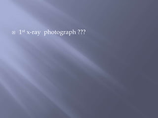  1st x-ray photograph ???
 