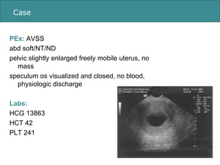 Case PEx:  AVSS abd soft/NT/ND pelvic slightly enlarged freely mobile uterus, no mass speculum os visualized and closed, n...