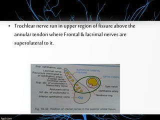 • Trochlear nerve run in upper region of fissure above the
annulartendonwhere Frontal & lacrimalnerves are
superolateral to it.
 