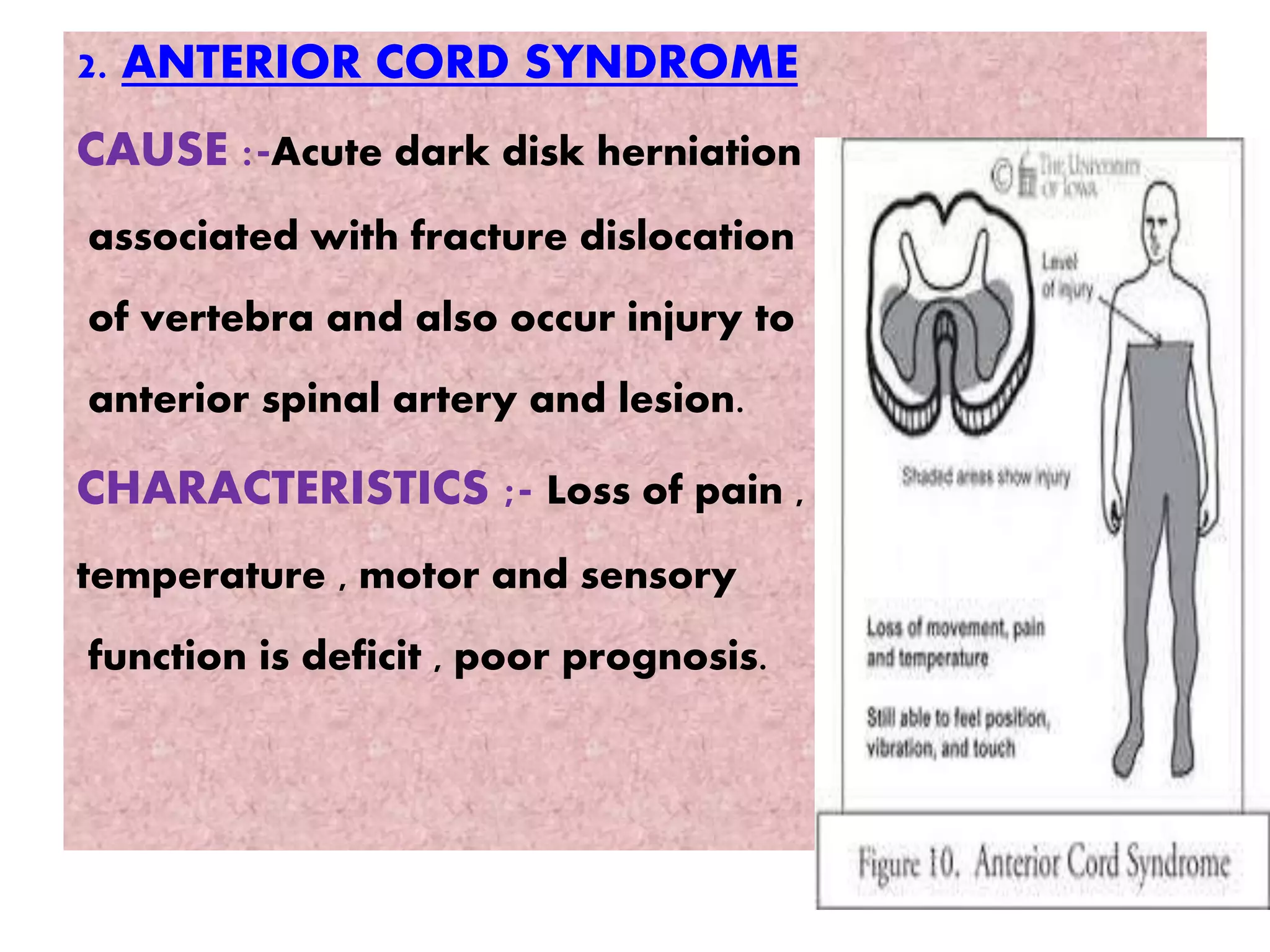 spinal cord injury ppt | PPTX