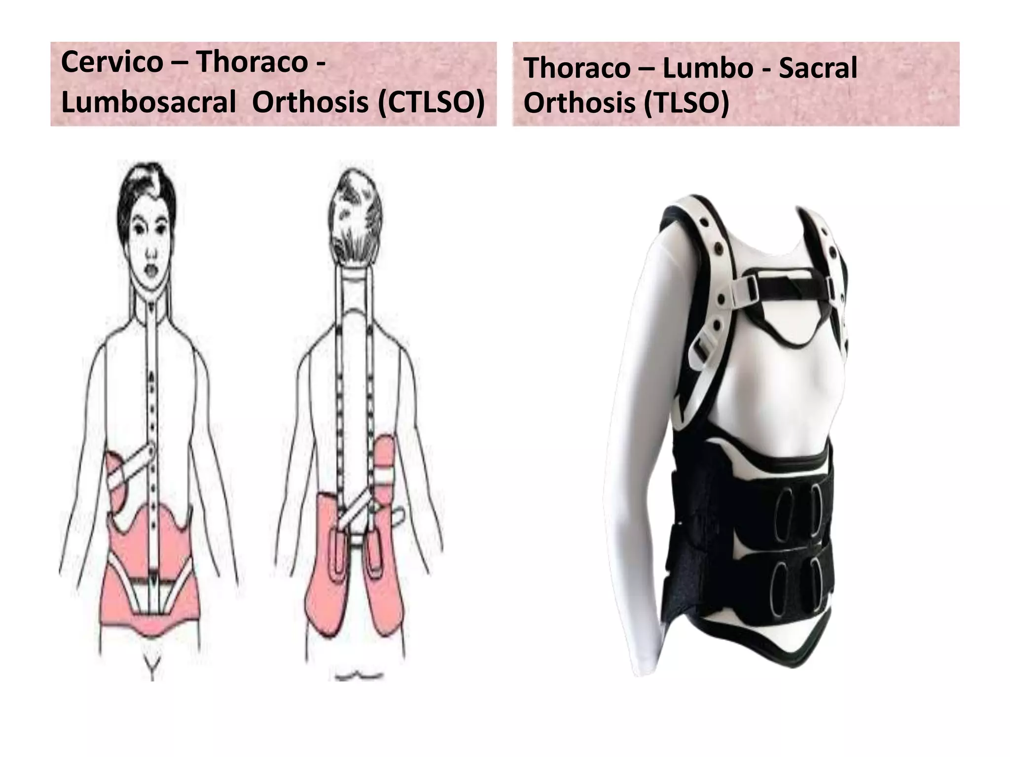 spinal cord injury ppt | PPTX