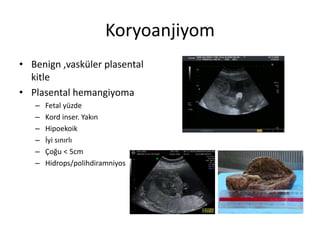 Koryoanjiyom
• Benign ,vasküler plasental
kitle
• Plasental hemangiyoma
– Fetal yüzde
– Kord inser. Yakın
– Hipoekoik
– İyi sınırlı
– Çoğu < 5cm
– Hidrops/polihdiramniyos
 
