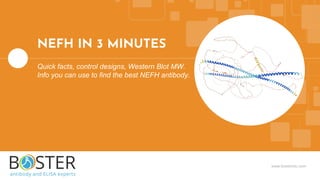 www.bosterbio.com
NEFH IN 3 MINUTES
Quick facts, control designs, Western Blot MW.
Info you can use to find the best NEFH antibody.
 