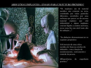 ABDUÇÕES E IMPLANTES – ENSAIO PARA UM FUTURO PRÓXIMO !ABDUÇÕES E IMPLANTES – ENSAIO PARA UM FUTURO PRÓXIMO !
“Os implantes são de material
metálico não existente na terra,
constituído por várias partículas
diferentes, envolvidos por uma
mebrana que parece ser do mesmo
material orgânico que o(a)
abduzido(a) e alguns implantes
estavam ligados a centros nervosos,
nessa zona fica um nível mais alto
de radiação ...”
“As abduções demonstraram ter os
seguintes propósitos:
 
1)A inserção de uma esfera
metálica de 3mm no cérebro do
abduzido... com a função de
monitoramento, rastreamento e
controle da pessoa.
2)Experiências de engenharia
genética.”
 