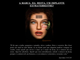 A MARCA DA BESTA, UM IMPLANTEA MARCA DA BESTA, UM IMPLANTE
EXTRATERRESTRE?EXTRATERRESTRE?
“E fez que a todos, pequenos e grandes, ricos e pobres, livres e escravos, lhes fosse
posto um sinal na mão direita, ou na fronte para que ninguém pudesse comprar ou
vender, senão aquele que tivesse o sinal, ou o nome da besta, ou o número do seu
nome. Aqui há sabedoria. Aquele que tem entendimento, calcule o número da besta;
porque é o número de um homem, e o seu número é seiscentos e sessenta e seis.”
Apocalipse 13:17,18
 