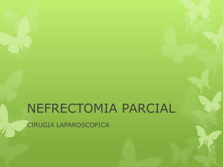 NEFRECTOMIA PARCIAL
CIRUGIA LAPAROSCOPICA
 