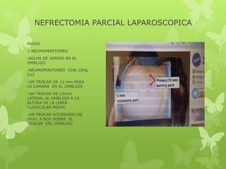 NEFRECTOMIA PARCIAL LAPAROSCOPICA

PASOS
1-NEUMOPERITONEO
-AGUJA DE VERESS EN EL
OMBLIGO
-NEUMOPERITONEO CON 15Hg
Co2
-UN TROCAR DE 12 mm PARA
LA CAMARA EN EL OMBLIGO
-UN TROCAR DE 12mm
LATERAL AL OMBLIGO A LA
ALTURA DE LA LINEA
CLAVICULAR MEDIA
-UN TROCAR ACCESORIO DE
5mm A 8cm SOBRE EL
TROCAR DEL OMBLIGO
 