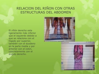 RELACION DEL RIÑON CON OTRAS
         ESTRUCTURAS DEL ABDOMEN




El riñón derecho esta
ligeramente más inferior
que el izquierdo debido a
que se relaciona con el
hígado por superior,
también con el duodeno
en la parte media y por
anterior con el colon,
concretamente con el
ángulo derecho.
 