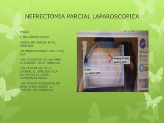 NEFRECTOMIA PARCIAL LAPAROSCOPICA

PASOS
6-IDENTIFICACION Y
OCLUSION DEL HILIO USANDO
CLAMPS DE BULLGOG (no mas
de 20 minu...