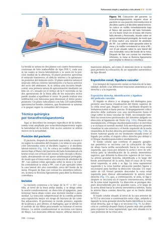 Nefrectomía simple y ampliada a cielo abierto E – 41-020
Figura 14. Colocación del paciente. La
toracofrenolaparotomía requiere situar al
paciente en una posición intermedia entre el
decúbito supino y el decúbito lateral estricto.
Se coloca un rodillo inmediatamente bajo
el ﬂanco del paciente del lado homolate-
ral a la lesión renal con el brazo del mismo
lado elevado y ﬂexionado, situado sobre un
apoyo antebraquial protegido, de modo que
el tórax realice una rotación de alrededor
de 30◦. Las caderas están apoyadas sobre la
mesa y la rodilla contralateral se sitúa a 90◦,
con el pie situado sobre la cara lateral del
otro extendido cerca del borde de la mesa.
Después de ﬁjar con correas los miembros
inferiores, la mesa se ﬂexiona ligeramente
para ampliar la distancia costoilíaca.
La herida se sutura en dos planos con cuatro hemisuturas
continuas de hilo reabsorbible de tipo PDS 1, cada una
se las cuales se inicia lateralmente y se unen en la por-
ción medial de la abertura. El plano posterior aproxima
el músculo transverso, el oblicuo interno y la aponeuro-
sis posterior del músculo recto. El plano anterior sutura el
músculo oblicuo externo lateralmente y la fascia anterior
del recto del abdomen. Si se utiliza una incisión bisub-
costal, una primera sutura de aproximación mediante un
hilo en «U» situado en el vértice de la V invertida en las
dos aponeurosis de la línea alba de los músculos rectos
puede ayudar a equilibrar el cierre. Se puede realizar una
inﬁltración con lidocaína para disminuir el dolor posto-
peratorio. Un plano subcutáneo con hilo 2/0 reabsorbible
aproxima los bordes cutáneos, que ﬁnalmente se suturan
o se grapan según la costumbre del cirujano.
Técnica quirúrgica
por toracofrenolaparotomía
Aquí se describen los tiempos especíﬁcos de la nefrec-
tomía total ampliada por toracofrenolaparotomía según
la lateralidad de la lesión. Este acceso anterior se utiliza
menos en la actualidad.
Posición del paciente
El paciente, después de insertarle una sonda, se rasura o
no según la costumbre del cirujano, y se sitúa en una posi-
ción intermedia entre el decúbito supino y el decúbito
lateral estricto (Fig. 14). Se coloca un rodillo inmediata-
mente bajo el ﬂanco del paciente del lado homolateral a la
lesión renal con el brazo del mismo lado elevado y ﬂexio-
nado, descansando en un apoyo antebraquial protegido,
de modo que el tórax realice una rotación de alrededor de
30◦
. Las caderas están apoyadas sobre la mesa y la rodi-
lla contralateral se sitúa a 90◦
, con el pie apoyado sobre
la cara lateral del otro extendido cerca del borde de la
mesa. Después de ﬁjar con correas los miembros inferio-
res, la mesa se ﬂexiona ligeramente para abrir la distancia
costoilíaca.
Incisión
La incisión comienza a lo largo de la 9.a
o 10.a
cos-
tilla, al nivel de la línea axilar media, y se dirige sobre
la unión condroesternal, en dirección al epigastrio, para
terminar hacia abajo como una incisión medial o para-
medial. La resección subperitoneal de la costilla permite
una exposición mejor sin riesgo de fractura de las costi-
llas adyacentes. El peritoneo se incide primero, seguido
de la pleura y, por último, el diafragma, que se divide en
el sentido de sus ﬁbras procurando no lesionar el nervio
frénico. La unión condroesternal se secciona con tijeras
de Mayo. Los músculos oblicuo mayor, oblicuo menor y
transverso delante, así como el músculo recto se inciden
para permitir la colocación de un separador autoestático
de tipo Ricard.
Exposición renal, ligadura vascular
Los tiempos de exposición varían en función de la late-
ralidad, debido a las diferentes relaciones anatómicas a la
derecha y a la izquierda.
Exposición derecha, identiﬁcación y ligadura
del pedículo vascular
El hígado se diseca y se despega del diafragma para
permitir una buena visualización del límite superior de
la celda renal que, llegado el caso, facilitaría después la
linfadenectomía si fuese precisa. El despegamiento cólico
derecho debe realizarse con una movilización hasta el
ciego sobre la línea vascular de Toldt, seccionando tam-
bién las inserciones peritoneales del intestino delgado en
dirección al ligamento de Treitz (Fig. 13A). Durante esta
manipulación, el bloque duodenopancreático se moviliza
y se rechaza en sentido medial. Esta movilización permite
visualizar la cara anterior y el borde izquierdo de la aorta
(maniobra de Kocher descrita previamente) (Fig. 13B). La
lesión tumoral queda en ese momento situada entre el
hígado por arriba, el ángulo cólico derecho por debajo y
el bloque duodenopancreático medialmente.
El tejido celular que contiene el paquete ganglio-
nar preaórtico se secciona con la colocación de clips
de abajo hacia arriba ascendiendo hacia la vena renal
izquierda, que cruza por delante la aorta y sirve de refe-
rencia para la identiﬁcación de la arteria mesentérica
superior, que delimita la disección superior de los vasos.
La arteria gonadal derecha, identiﬁcada a lo largo del
borde anterolateral de la aorta, bajo el cruce de la vena
renal izquierda, se aísla y se liga. La vena suprarrenal
izquierda y la vena lumbar adyacente pueden ligarse y
seccionarse para facilitar la disección vascular. Un sepa-
rador de Gil Vernet permite descender la vena renal
izquierda para disecar adecuadamente la arteria renal
derecha (Fig. 15), que, a continuación, se aísla, se liga y
después se secciona en el espacio interaortocava, detrás
de la vena renal izquierda. La disección se prosigue des-
pués descendiendo por los grandes vasos, a lo largo de
la aorta distal hacia la arteria mesentérica inferior, hasta
la arteria ilíaca común derecha, que es su límite distal
inferior.
El tejido celular situado al nivel de la cara anterior de
la VCI se secciona a continuación entre clips, aislando y
ligando la vena gonadal derecha hasta identiﬁcar la vena
renal derecha, que se liga y se secciona (Fig. 9). La disec-
ción se continúa después hasta el punto más alto posible
para exponer la vena suprarrenal, que está situada en la
cara posterior de la vena cava.
EMC - Urología 11
 
