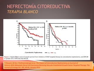 NEFRECTOMÍA CITOREDUCTIVA 
TERAPIA BLANCO 
T Choueiri, W Xie, C Kollmannsberger et al. The Impact of Cytoreductive Nephrectomy on Survival of 
Patients With Metastatic Renal Cell Carcinoma Receiving Vascular Endothelial Growth Factor Targeted Therapy. The 
Journal of Urology Vol. 185, 60-66, January 2011 
 