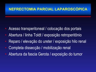 NEFRECTOMIA PARCIAL LAPAROSCÓPICA Acesso transperitoneal / colocação dos portais Abertura / linha Toldt / exposição retroperitônio Reparo / elevação do ureter / exposição hilo renal Completa dissecção / mobilização renal  Abertura da fascia Gerota / exposição do tumor 