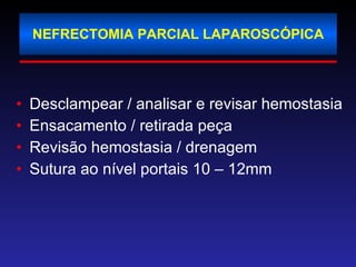 NEFRECTOMIA PARCIAL LAPAROSCÓPICA Desclampear / analisar e revisar hemostasia Ensacamento / retirada peça Revisão hemostasia / drenagem Sutura ao nível portais 10 – 12mm 