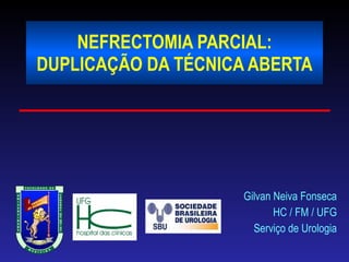 NEFRECTOMIA PARCIAL: DUPLICAÇÃO DA TÉCNICA ABERTA Gilvan Neiva Fonseca HC / FM / UFG Serviço de Urologia 