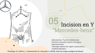 Nefrectomia radical.pptx