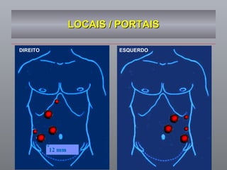 LOCAIS / PORTAIS DIREITO ESQUERDO 