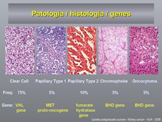 Patologia / histologia / genes Update postgraduate courses - Kidney cancer – AUA - 2008 