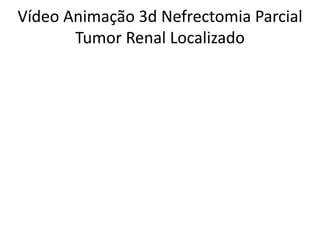 Vídeo Animação 3d Nefrectomia Parcial
Tumor Renal Localizado
 