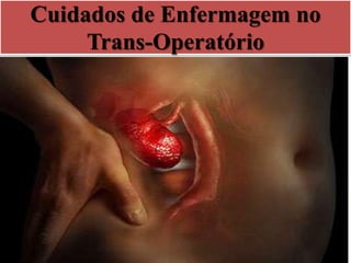 Cuidados de Enfermagem no
Trans-Operatório
 