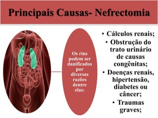 Principais Causas- Nefrectomia
Os rins
podem ser
danificados
por
diversas
razões
dentre
elas:
• Cálculos renais;
• Obstrução do
trato urinário
de causas
congênitas;
• Doenças renais,
hipertensão,
diabetes ou
câncer;
• Traumas
graves;
 
